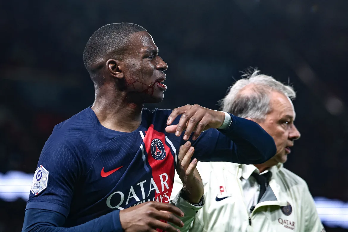Paris Saint-Germain's French defender #26 Nordi Mukiele is assisted by PSG doctor Patrick Flamant as he walks off on injury during the French L1 football match between Paris Saint-Germain (PSG) and Clermont Foot 63 at the Parc des Princes stadium in Paris on April 6, 2024. (AFP Photo)